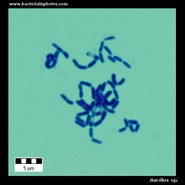 bacillus microscopy